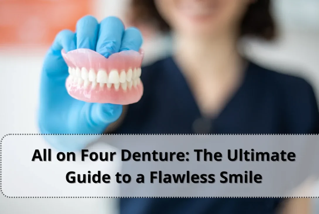 All on Four Denture